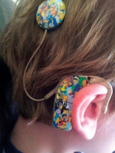 Cochlear implant decorated with Simpsons characters