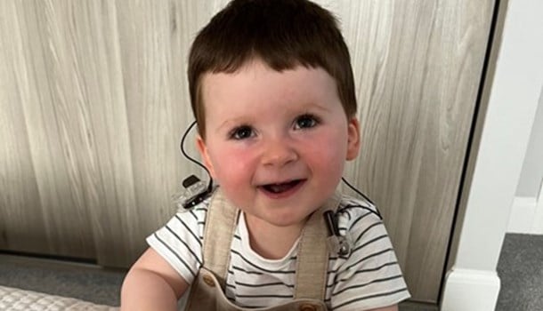 A baby boy with cochlear implants smiles at the camera